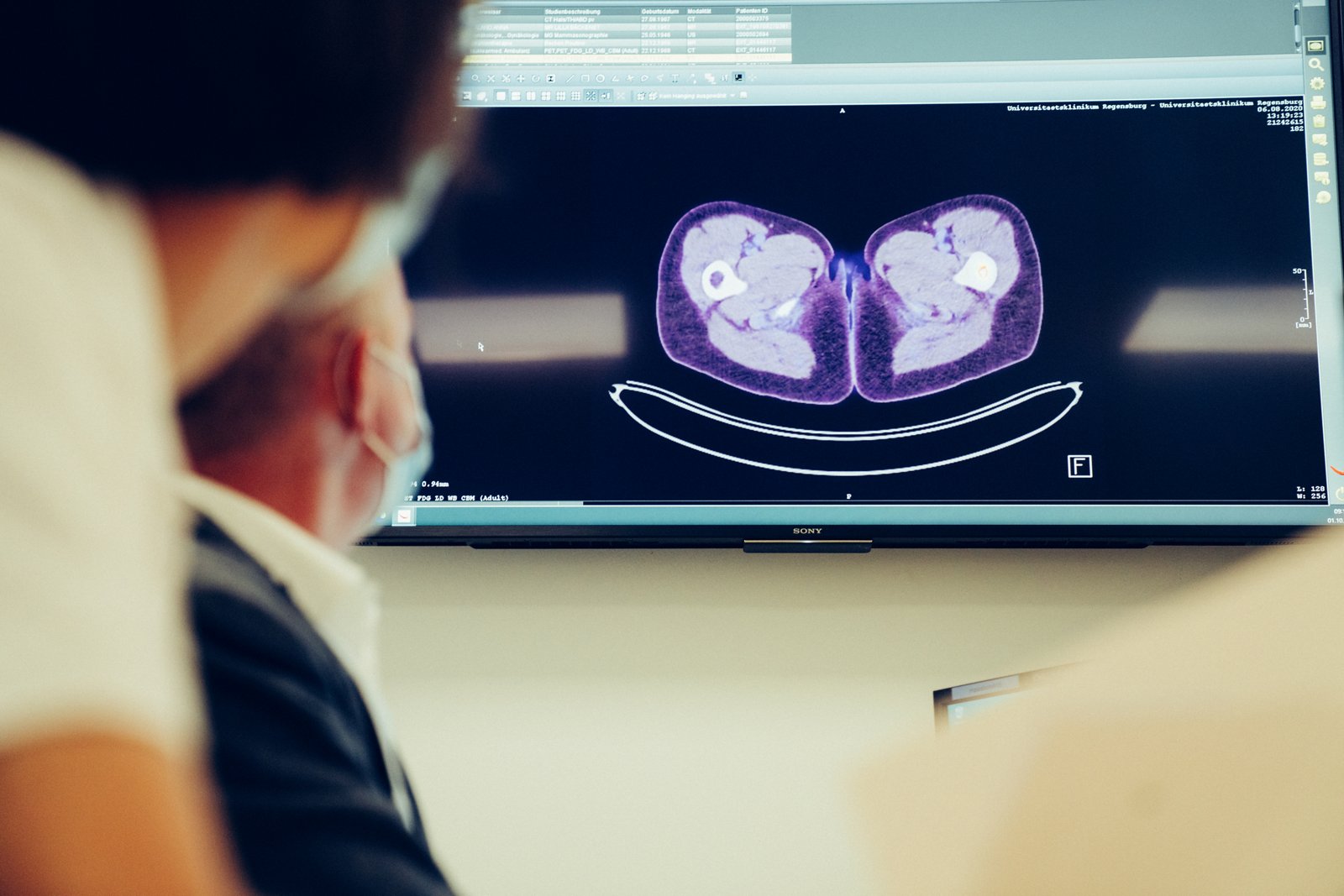 Урологическая онкология в Хелиос Крефельд